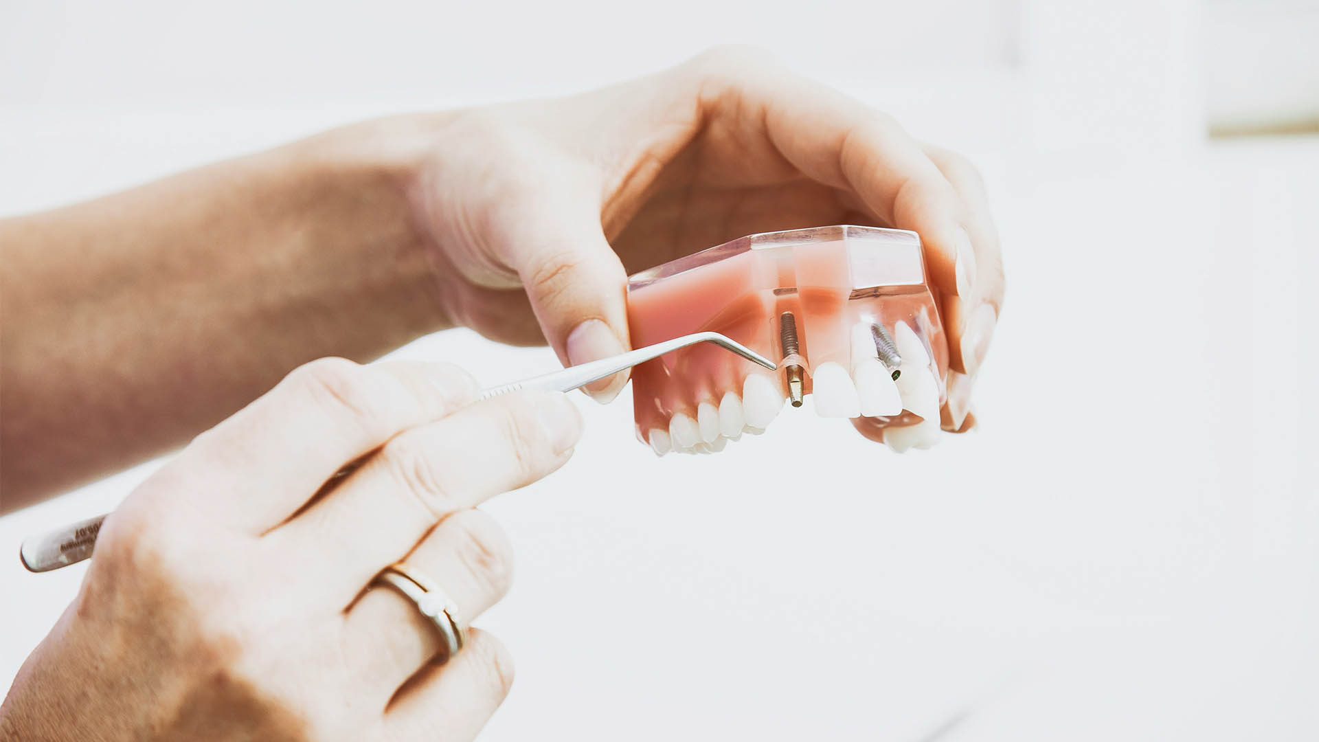 <h2><span data-teams="true"><span dir="ltr">The Rising Price of Smiles: Overcoming Inflation Challenges in Dental Implant Production</span></span></h2>