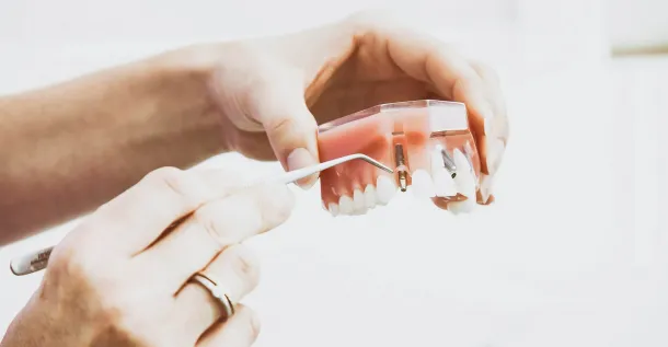 <h2><span data-teams="true"><span dir="ltr">The Rising Price of Smiles: Overcoming Inflation Challenges in Dental Implant Production</span></span></h2> 