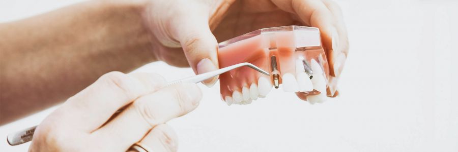 <h2><span data-teams="true"><span dir="ltr">The Rising Price of Smiles: Overcoming Inflation Challenges in Dental Implant Production</span></span></h2>